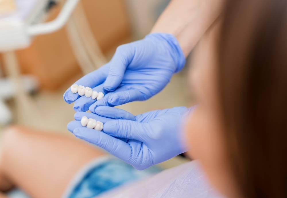 CONHEÇA 7 VANTAGENS DAS FACETAS DE PORCELANA